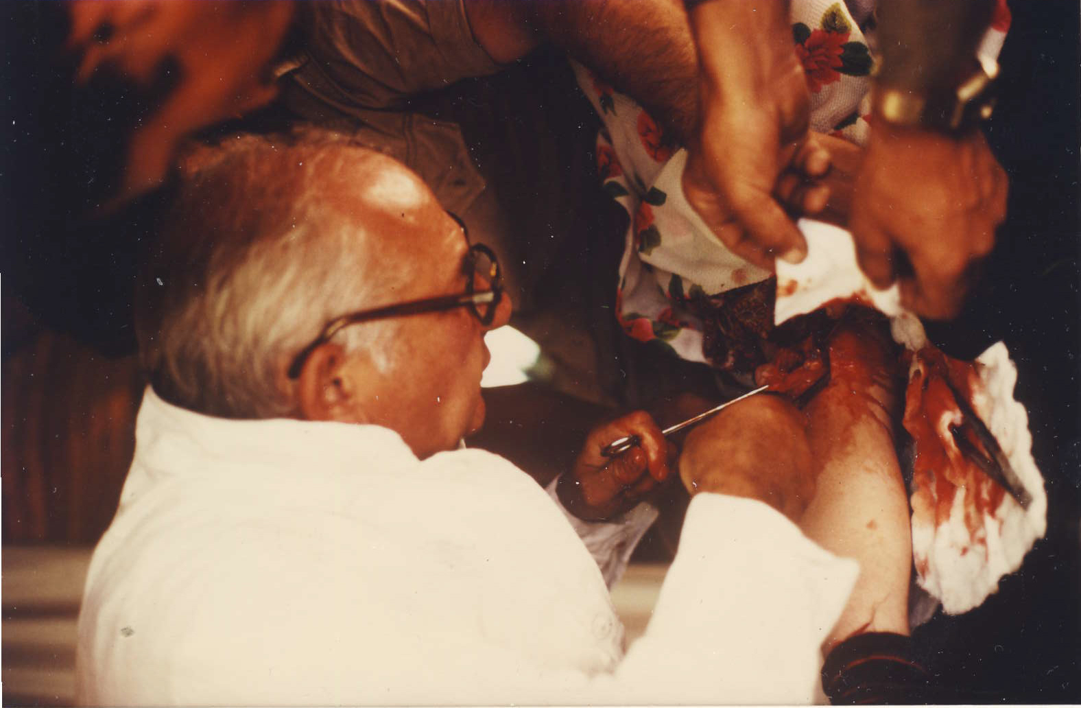 Polní operace s prof.Ballem v Iranánu -1980